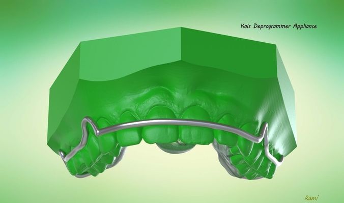 Digital Kois Deprogrammer Appliance 3D print model