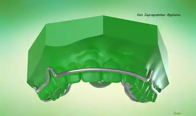 Digital Kois Deprogrammer Appliance 3D print model