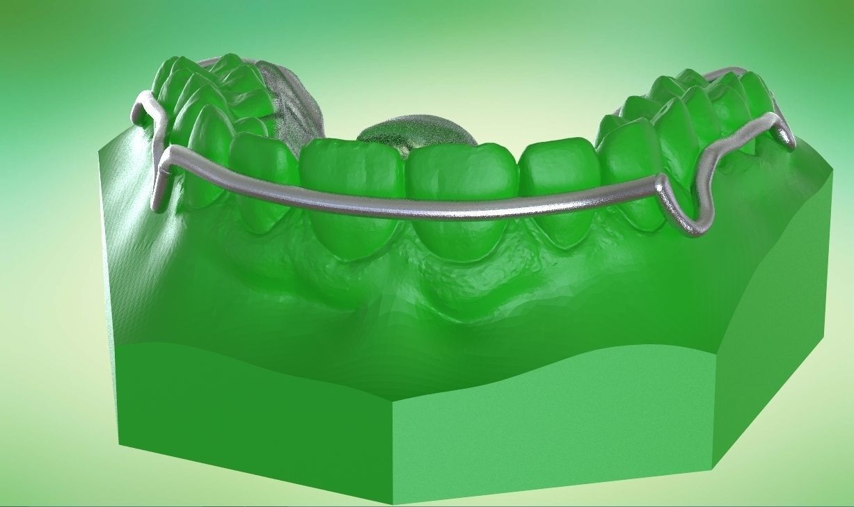 Digital Kois Deprogrammer Appliance 3D print model_6