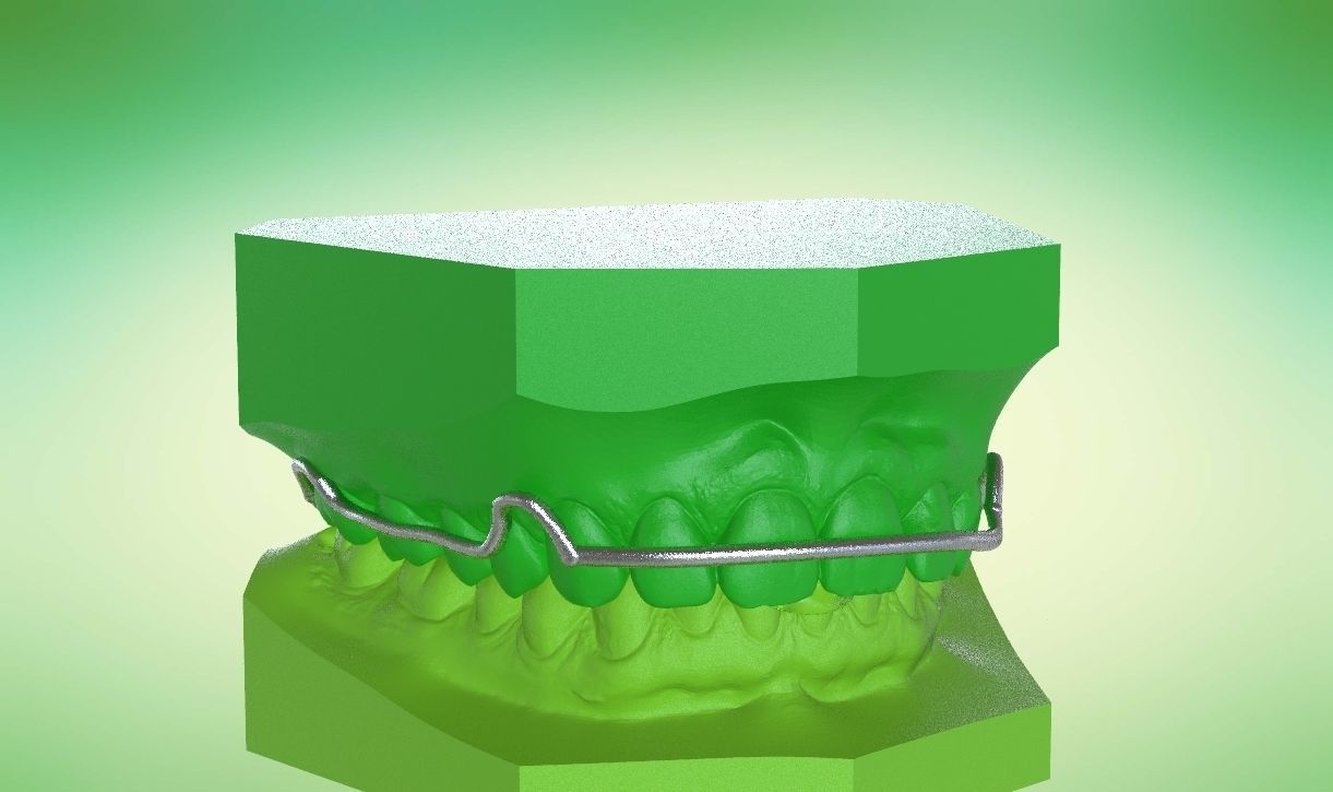 Digital Kois Deprogrammer Appliance 3D print model_19