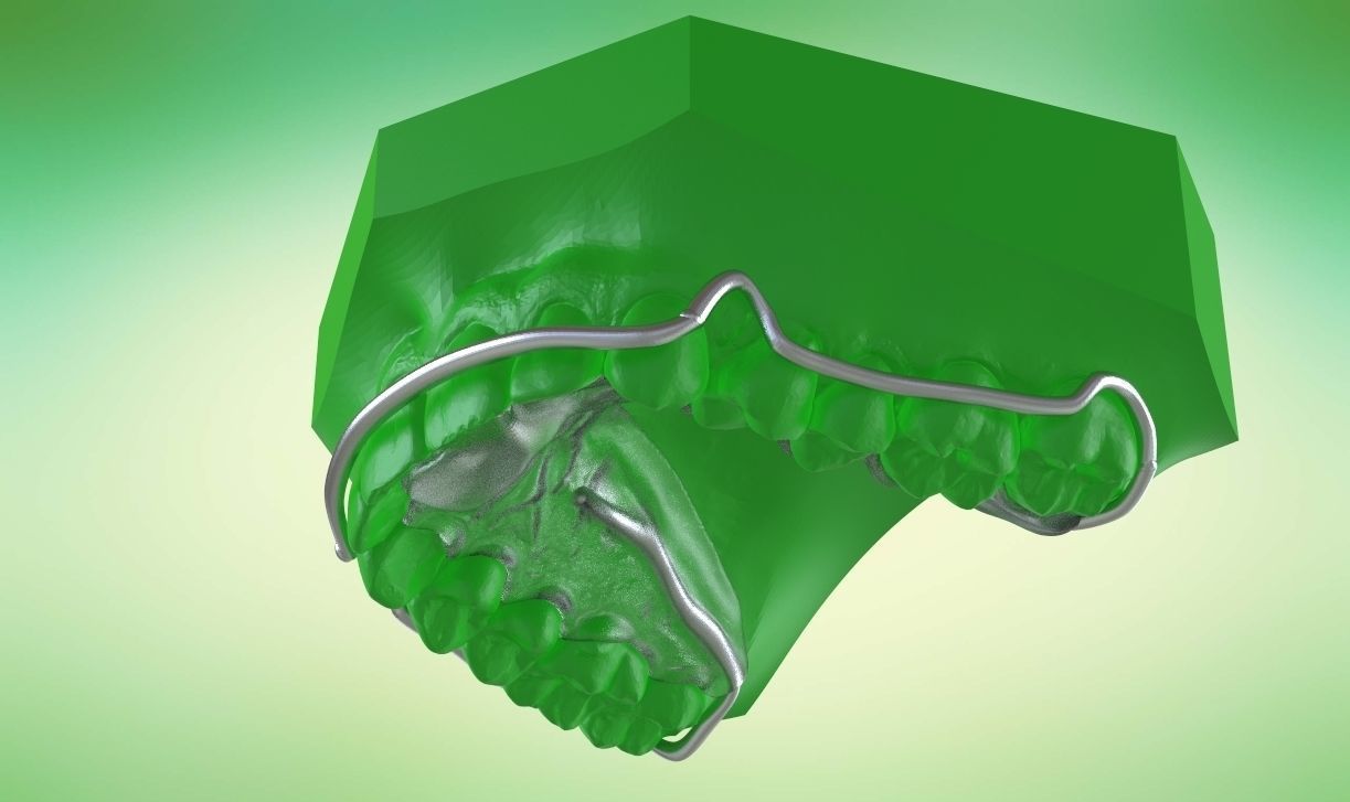 Digital Kois Deprogrammer Appliance 3D print model_2