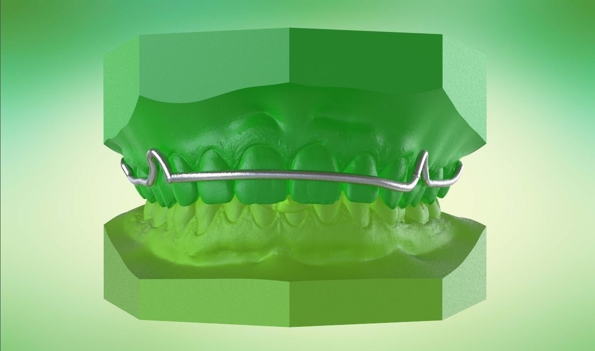 Digital Kois Deprogrammer Appliance 3D print model_11