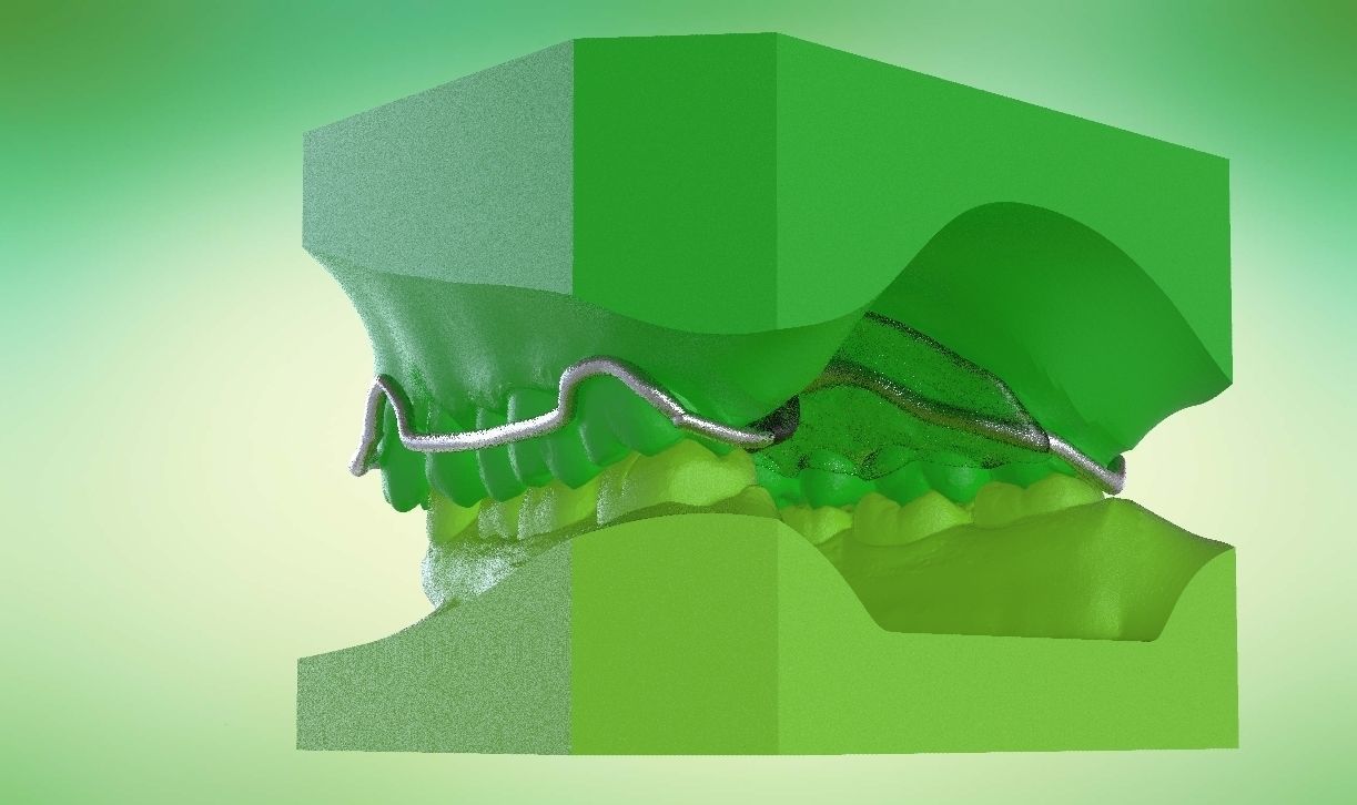 Digital Kois Deprogrammer Appliance 3D print model_17