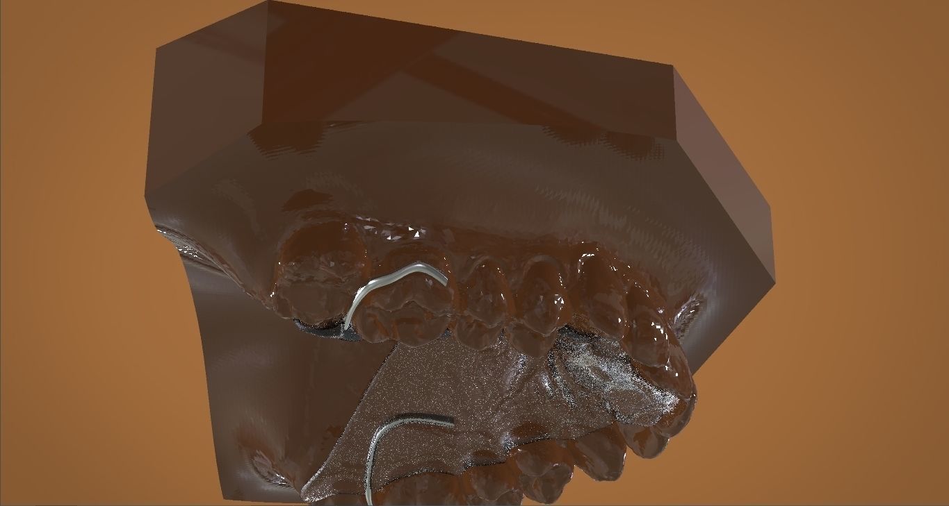 Digital DTI Deprogrammer Appliance 3D print model_8