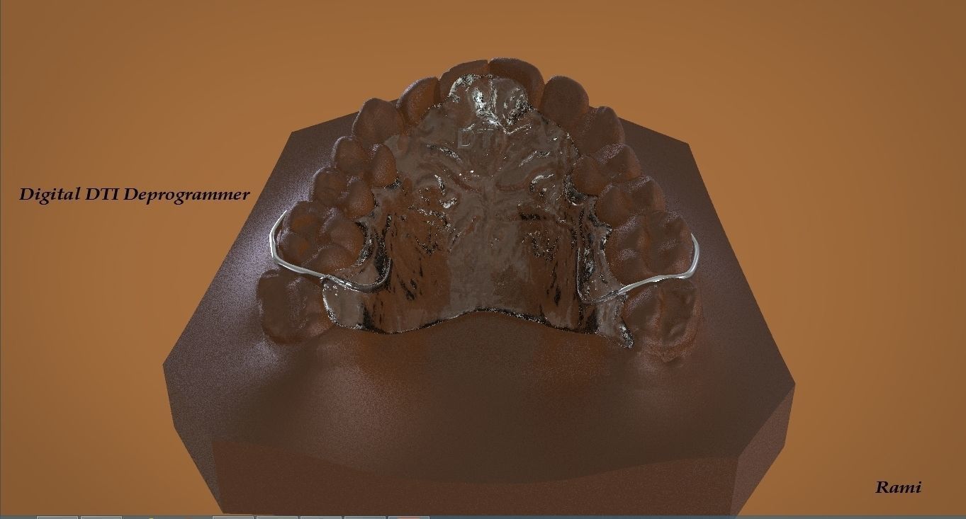 Digital DTI Deprogrammer Appliance 3D print model_4