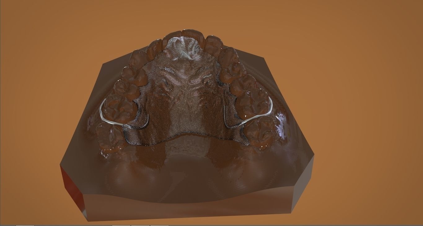Digital DTI Deprogrammer Appliance 3D print model_5