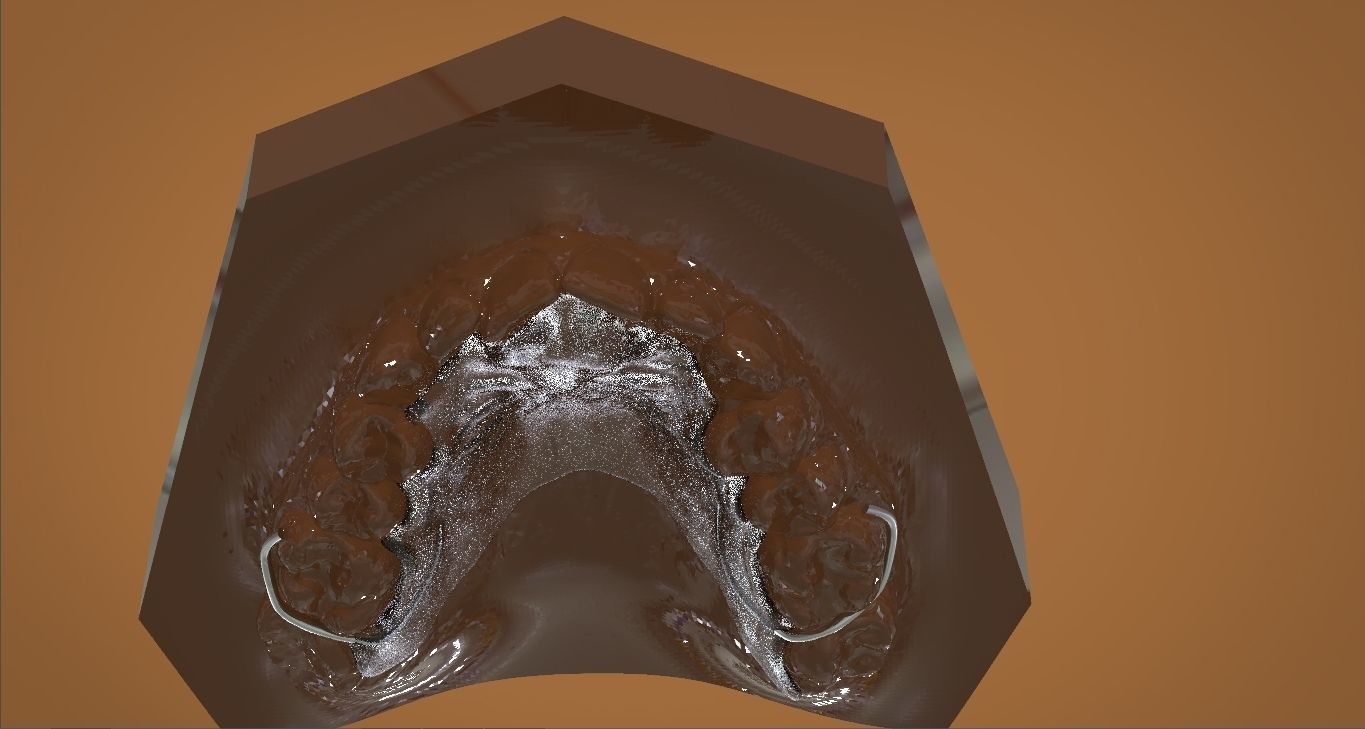 Digital DTI Deprogrammer Appliance 3D print model_7