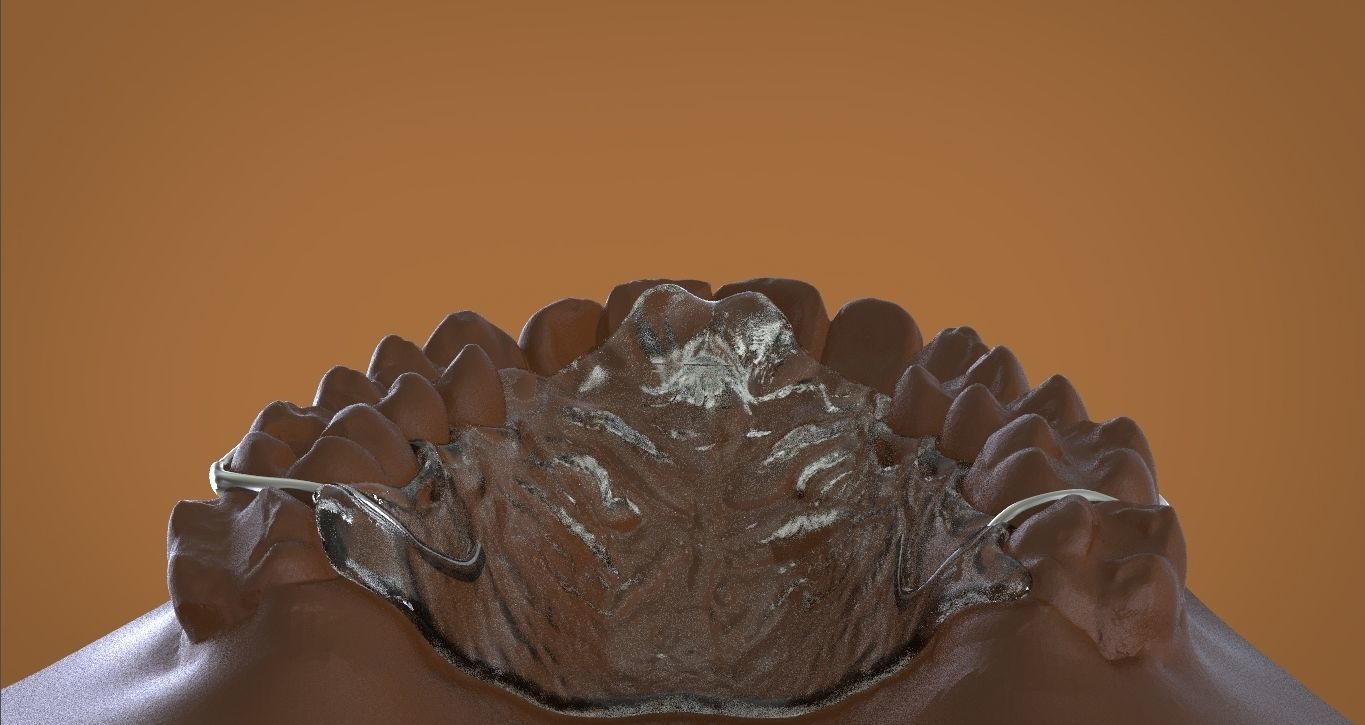Digital DTI Deprogrammer Appliance 3D print model_13