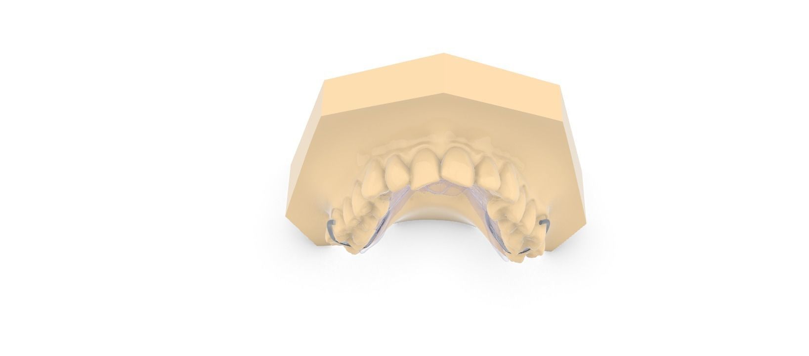 Digital DTI Deprogrammer Appliance 3D print model_3