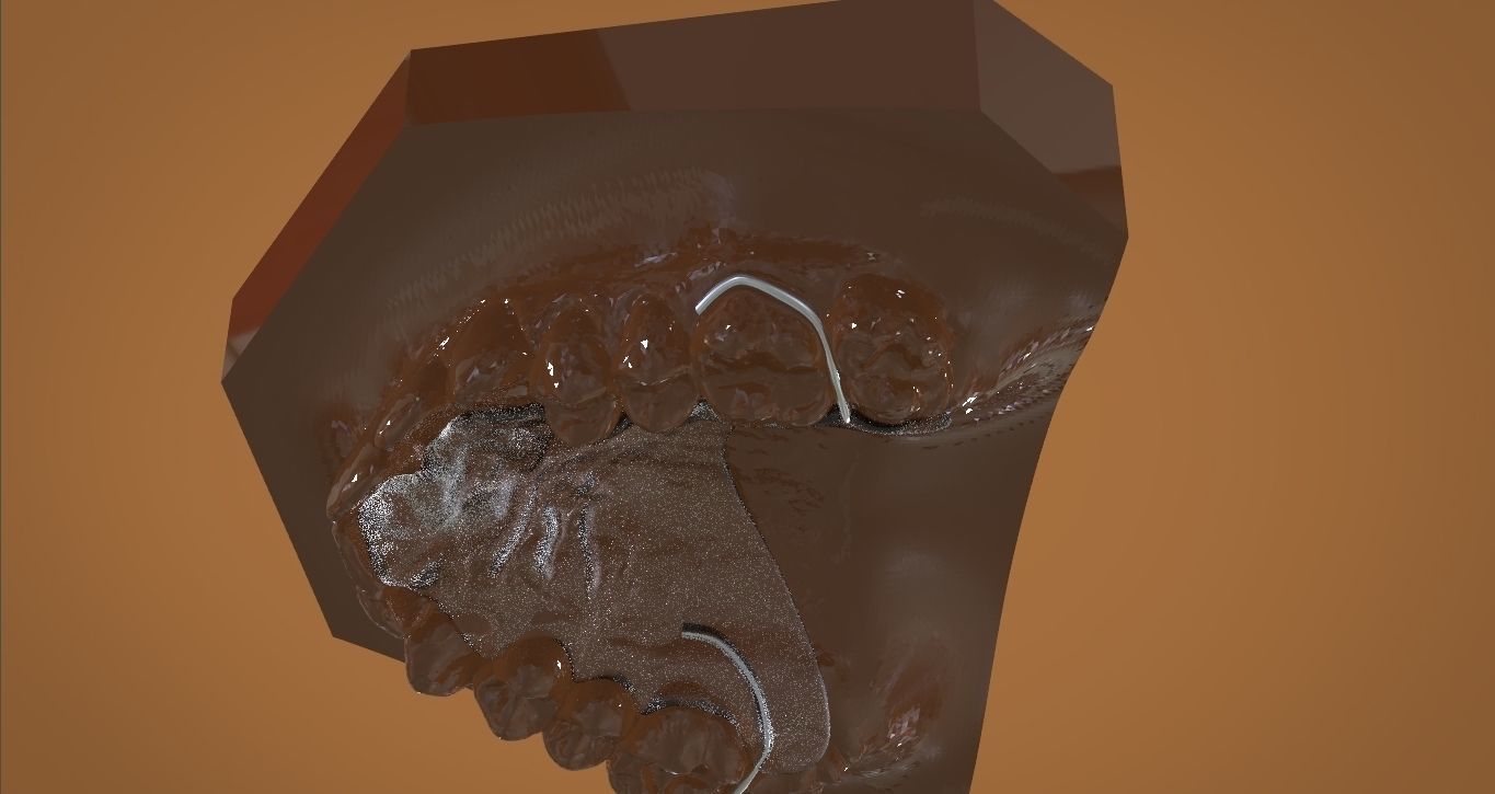Digital DTI Deprogrammer Appliance 3D print model_6
