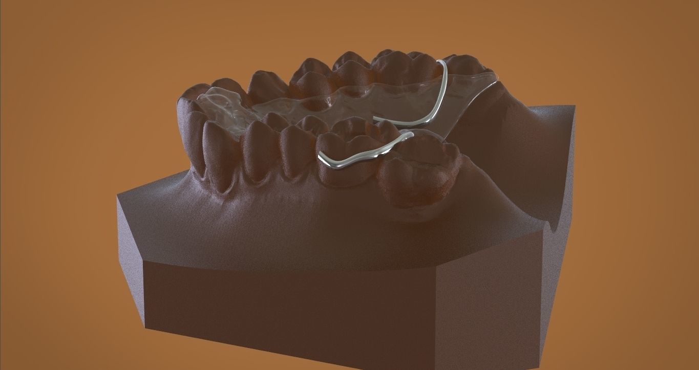 Digital DTI Deprogrammer Appliance 3D print model_9