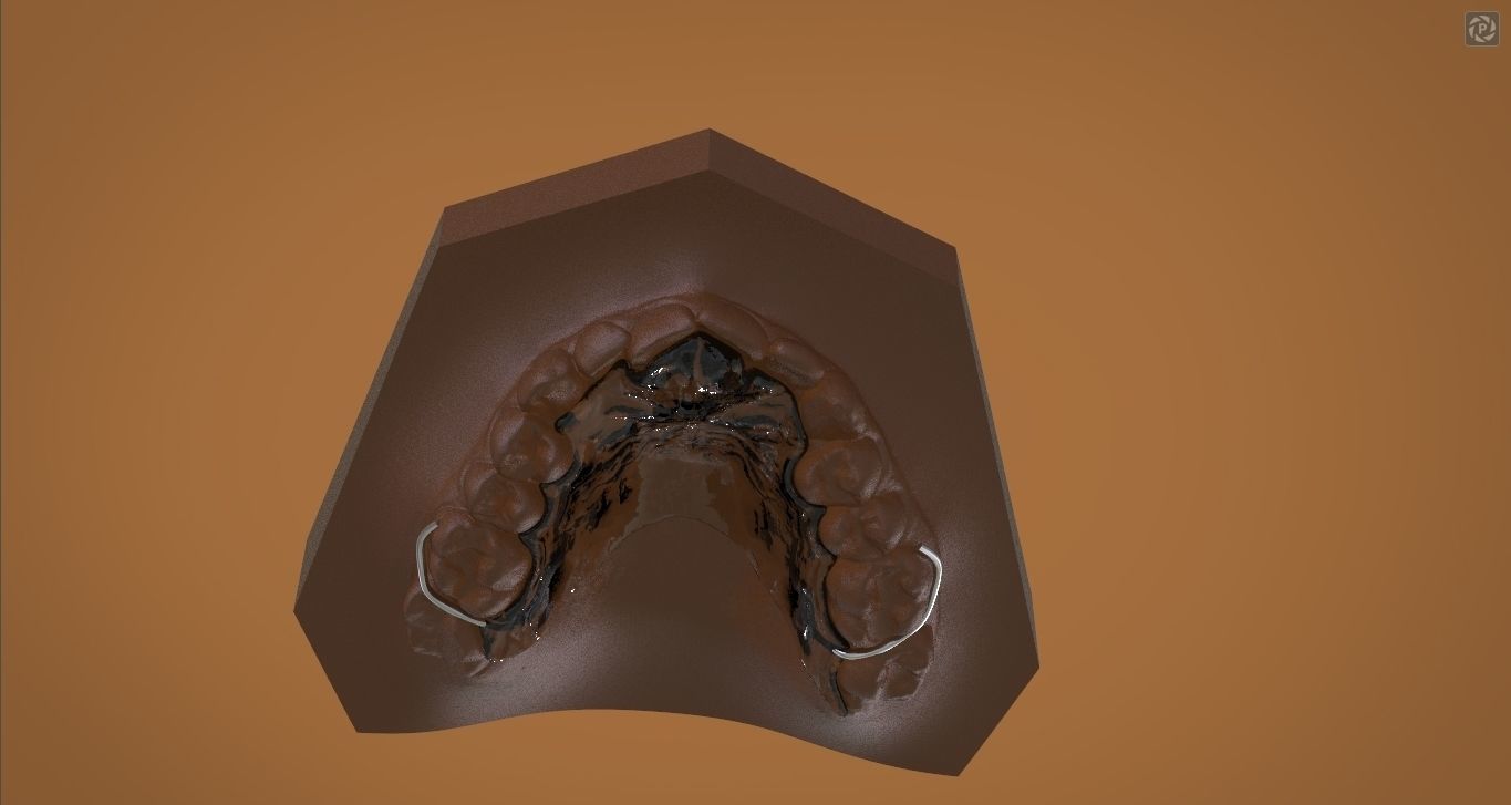 Digital DTI Deprogrammer Appliance 3D print model_14