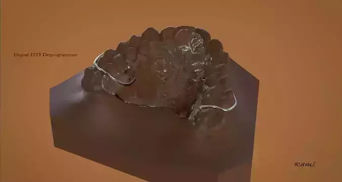 Digital DTI Deprogrammer Appliance 3D print model