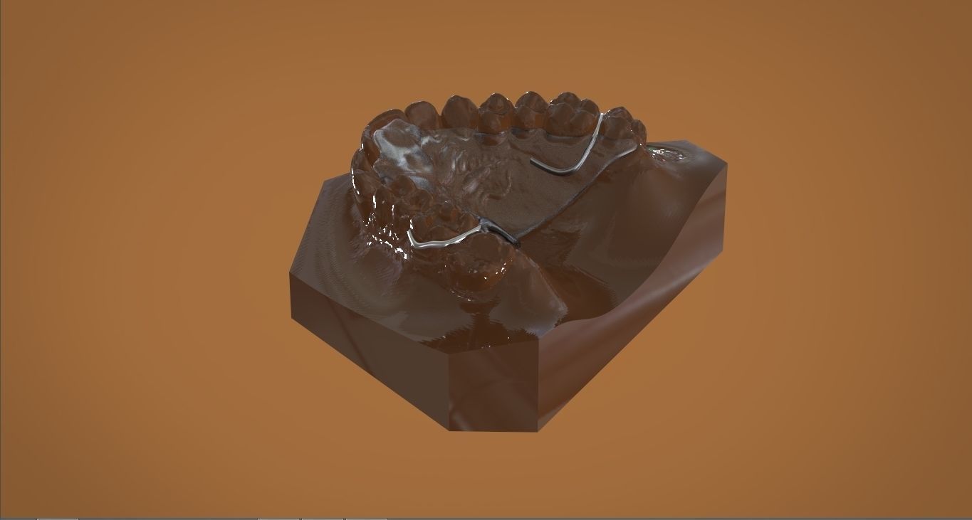 Digital DTI Deprogrammer Appliance 3D print model_12