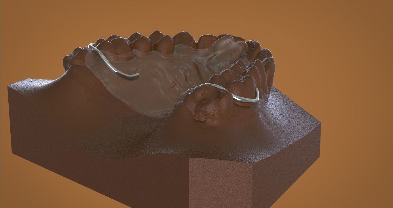 Digital DTI Deprogrammer Appliance 3D print model_11