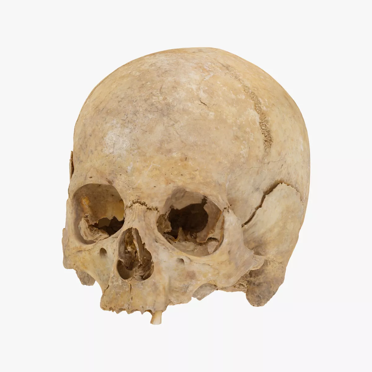 Real Broken Human Skull Carnial 01 RAW SCAN 3D model