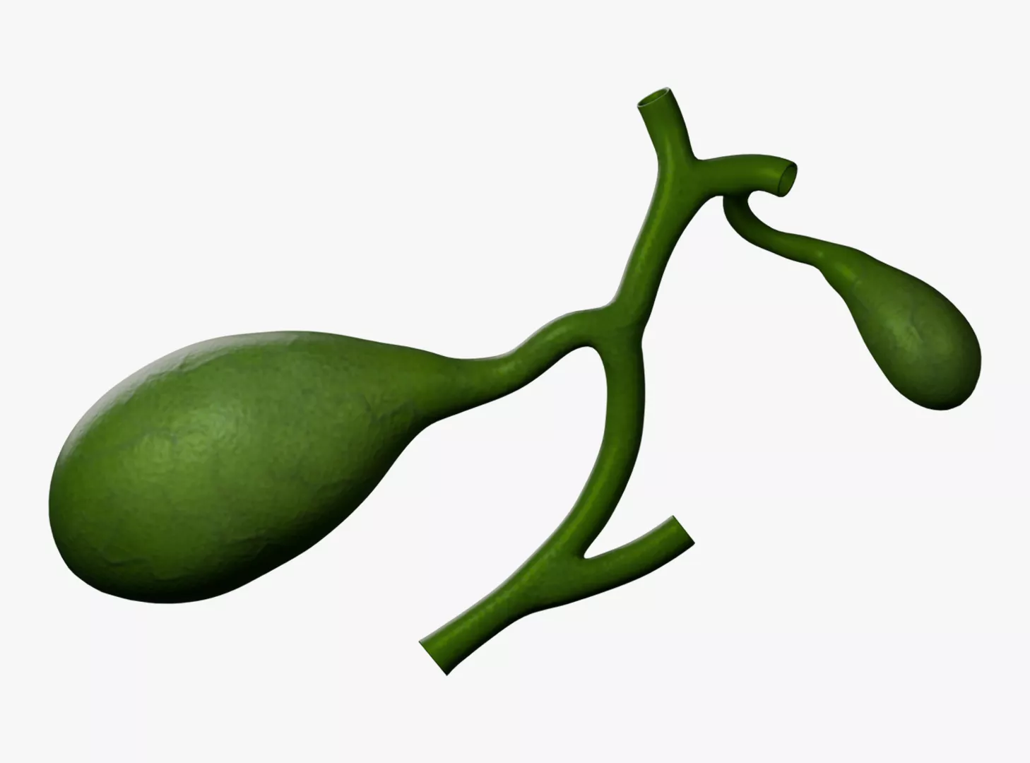 Gallbladder Type 2 Separated cystic ducts Left Trabecular 3D model