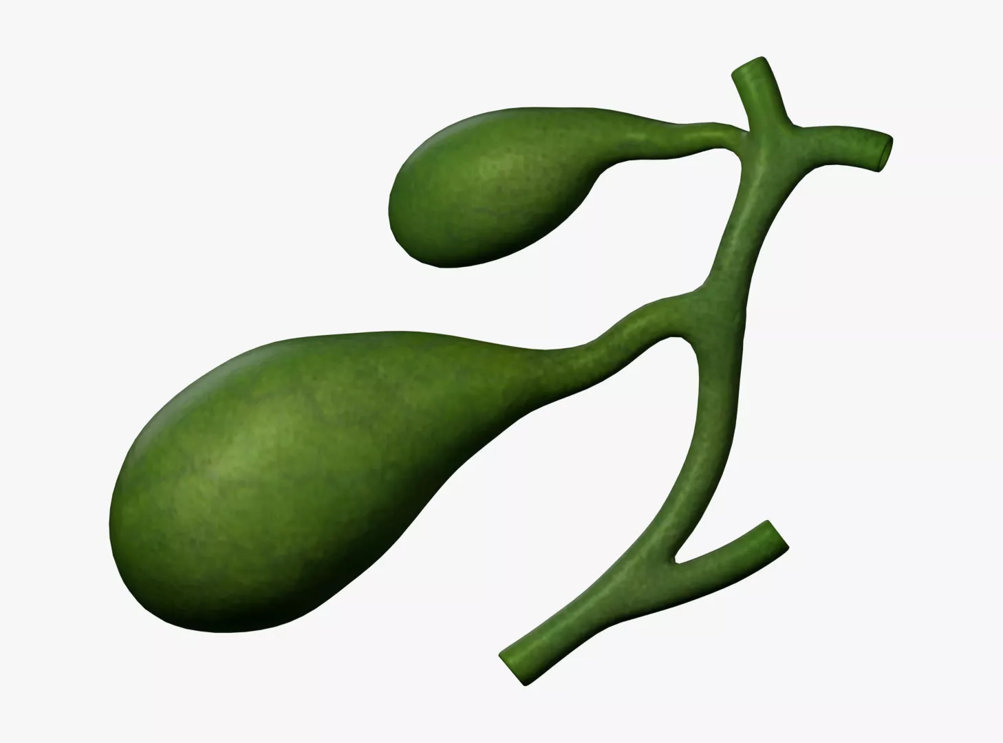 Gallbladder Type 2 Separated cystic ducts Right Trabecular 3D model