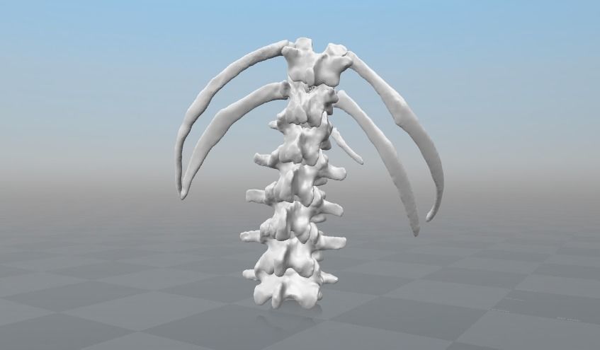 Lumbar rib - 13th extra rib 3D model_2