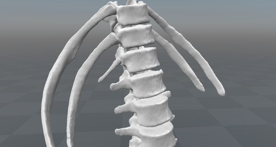 Lumbar rib - 13th extra rib 3D model_4