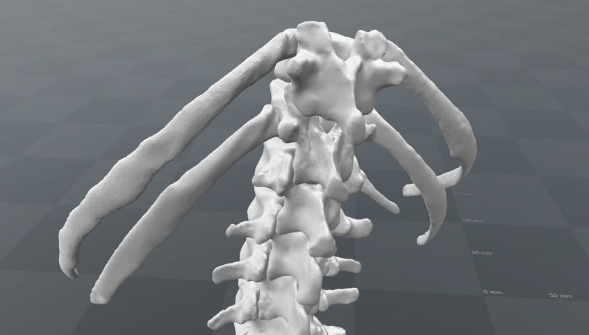 Lumbar rib - 13th extra rib 3D model_3