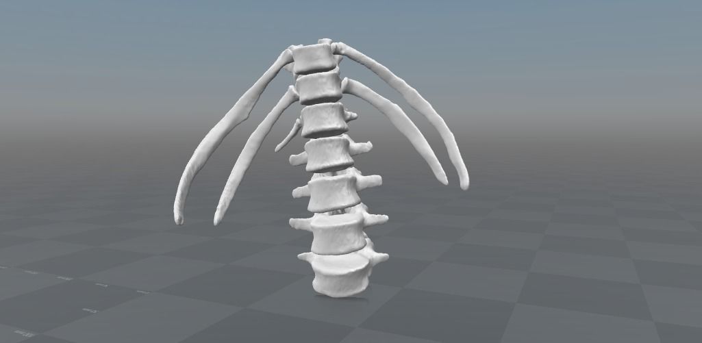 Lumbar rib - 13th extra rib 3D model_5
