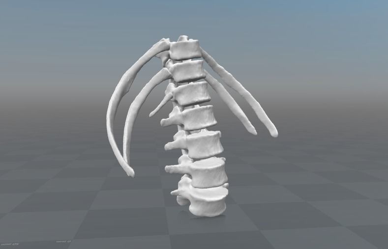 Lumbar rib - 13th extra rib 3D model_0