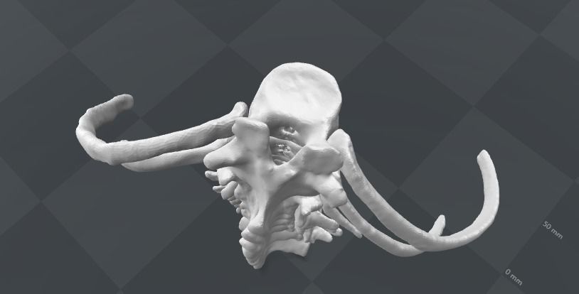 Lumbar rib - 13th extra rib 3D model_1