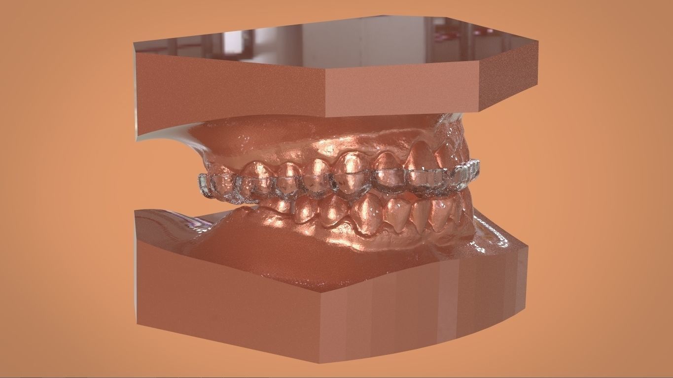 Digital KOIS Style Nightguard 3D print model_3