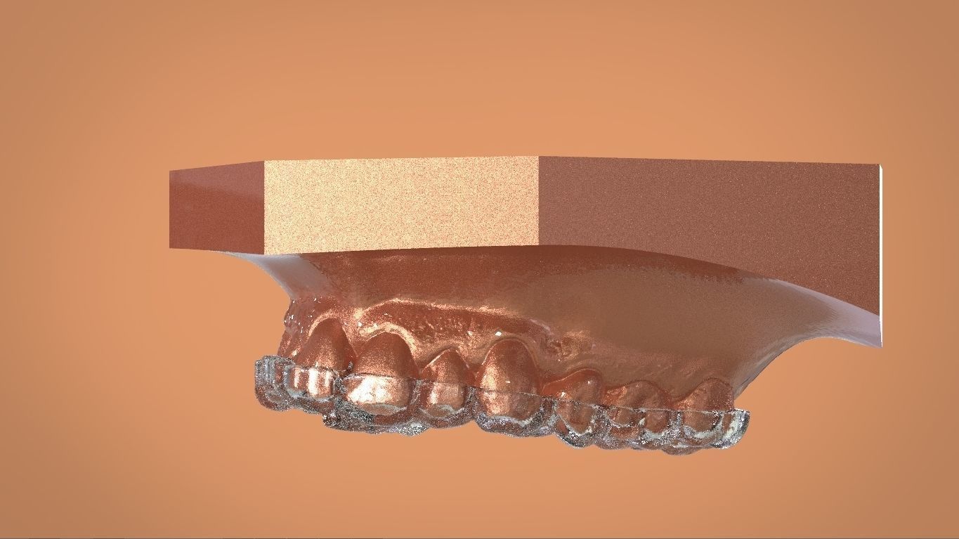 Digital KOIS Style Nightguard 3D print model_13