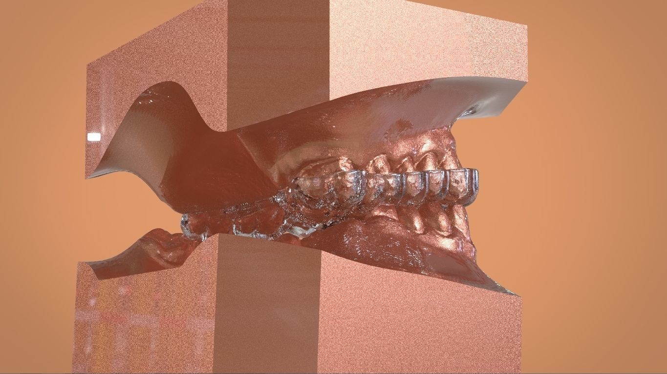 Digital KOIS Style Nightguard 3D print model_5