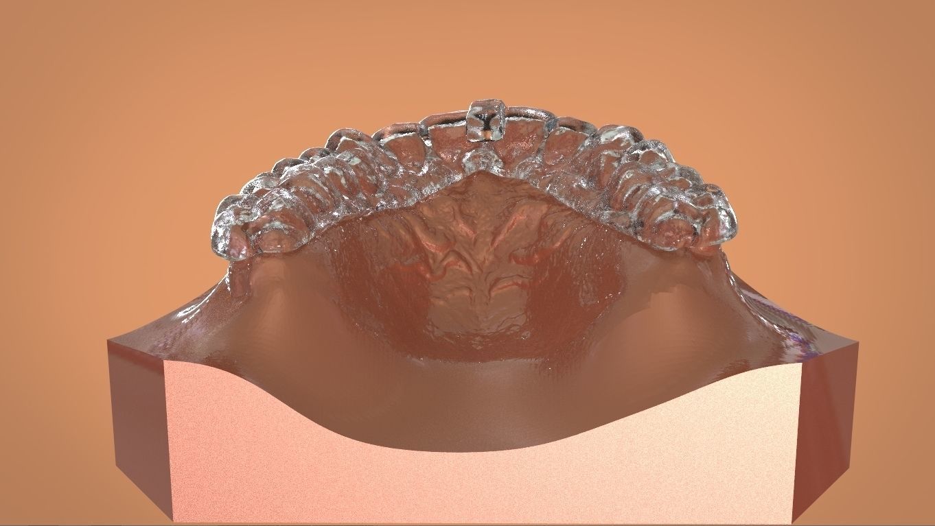 Digital KOIS Style Nightguard 3D print model_14