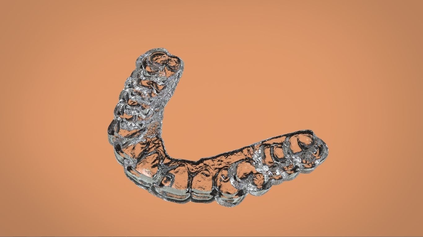 Digital KOIS Style Nightguard 3D print model_15