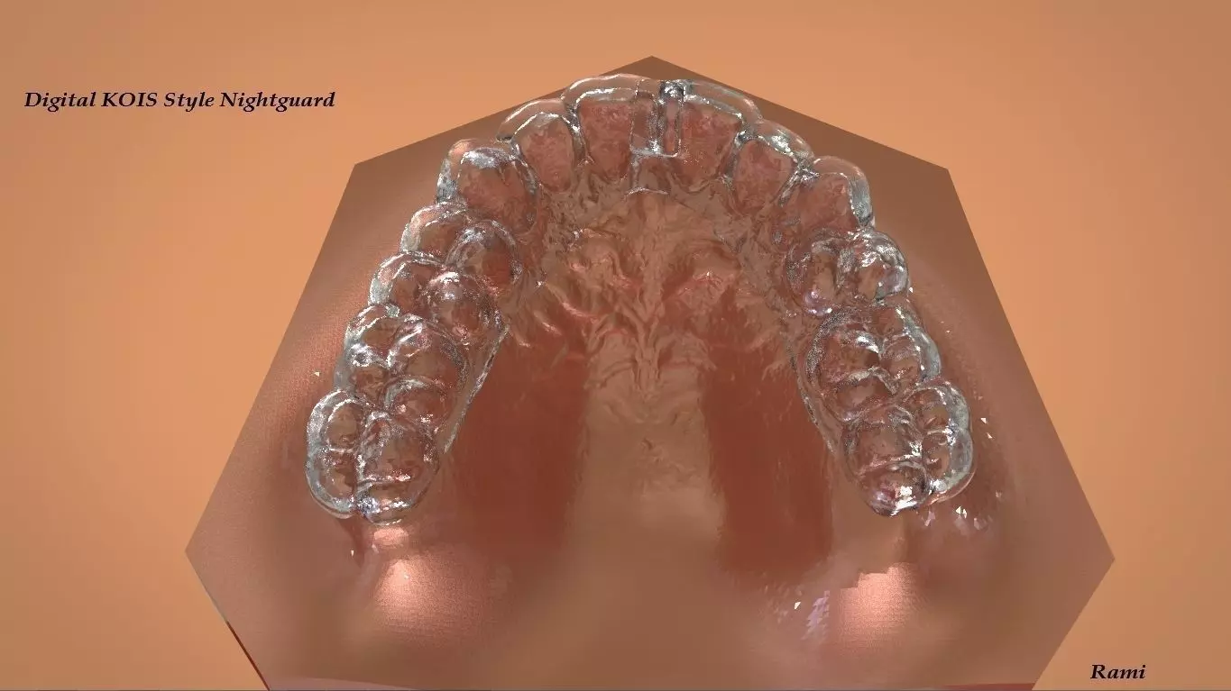 Digital KOIS Style Nightguard 3D print model_0