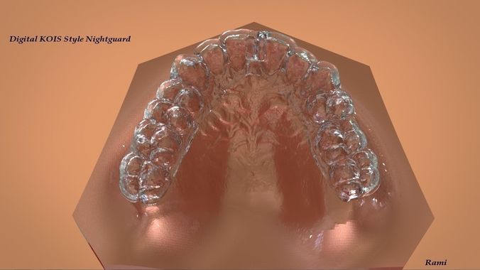 Digital KOIS Style Nightguard 3D print model