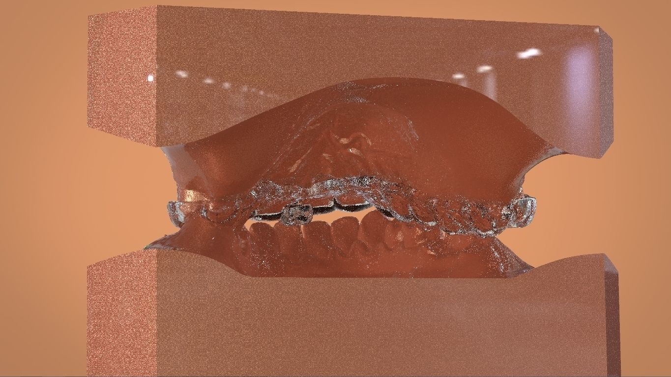 Digital KOIS Style Nightguard 3D print model_7