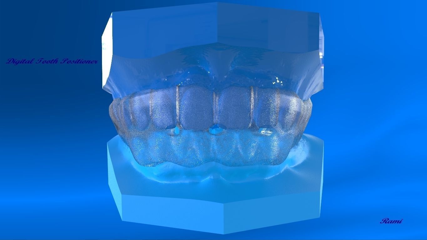 Digital Ortho Tooth Positioner 3D model 3D printable CGTrader