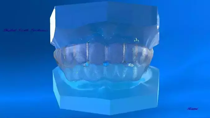 Digital Ortho Tooth Positioner