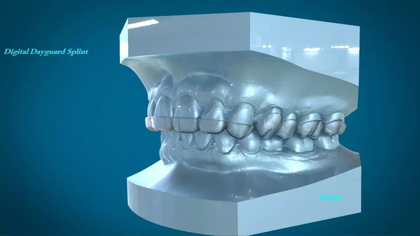 Digital Dayguard Splint 3D print model_0