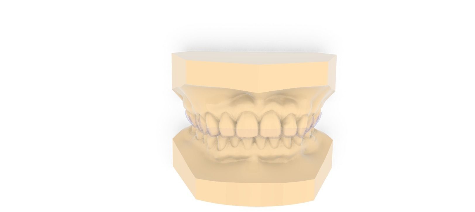 Digital Dayguard Splint 3D print model_3