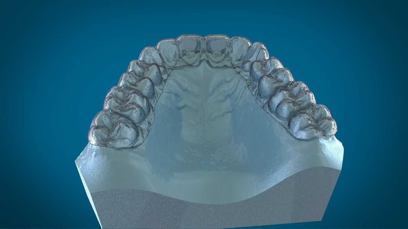 Digital Dayguard Splint 3D print model_9