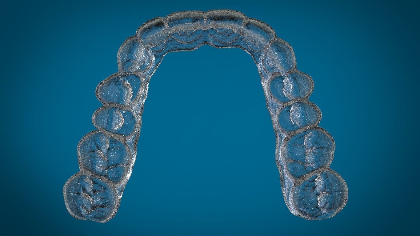Digital Dayguard Splint 3D print model_11