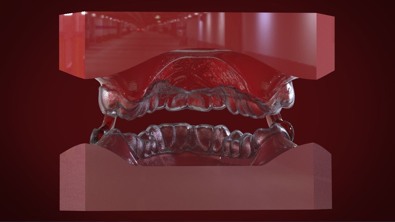 Digital Sleep Apnea Mouthguard 3D print model_10