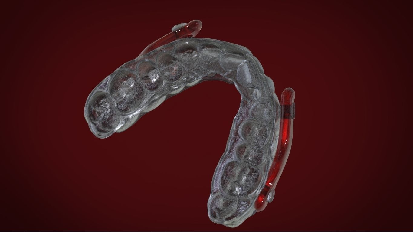 Digital Sleep Apnea Mouthguard 3D print model_13
