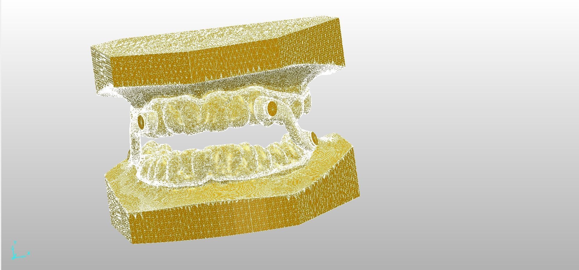 Digital Sleep Apnea Mouthguard 3D print model_5