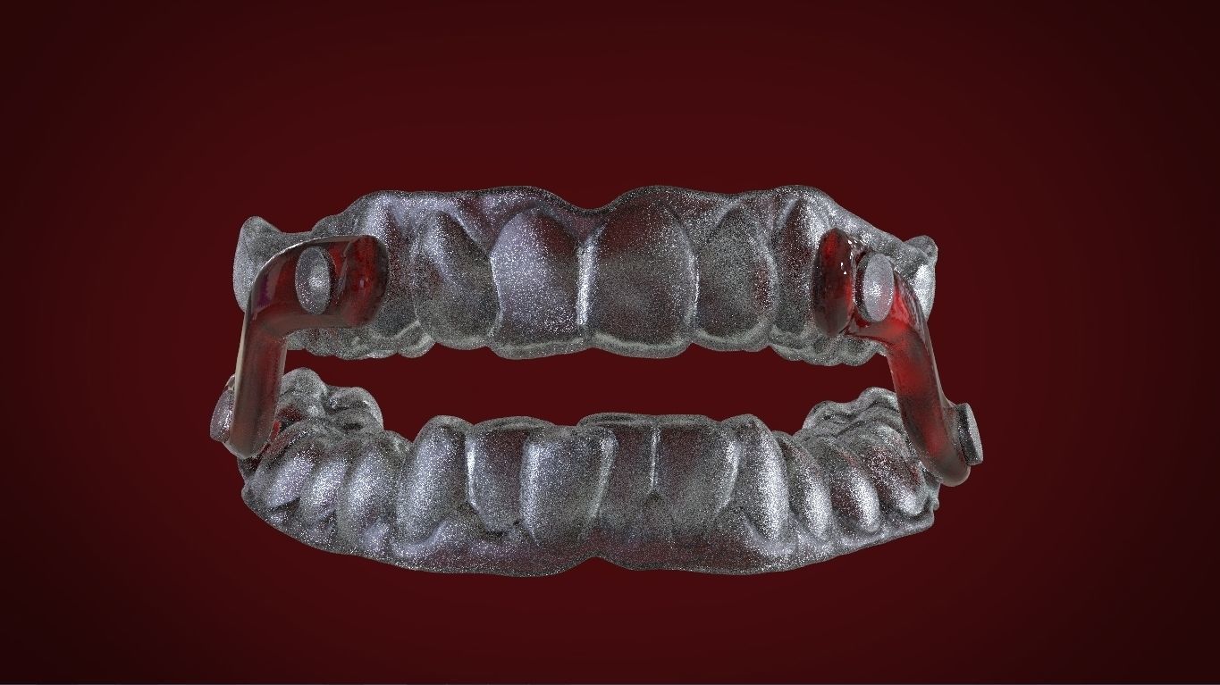 Digital Sleep Apnea Mouthguard 3D print model_11