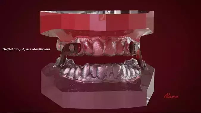 Digital Sleep Apnea Mouthguard 3D print model