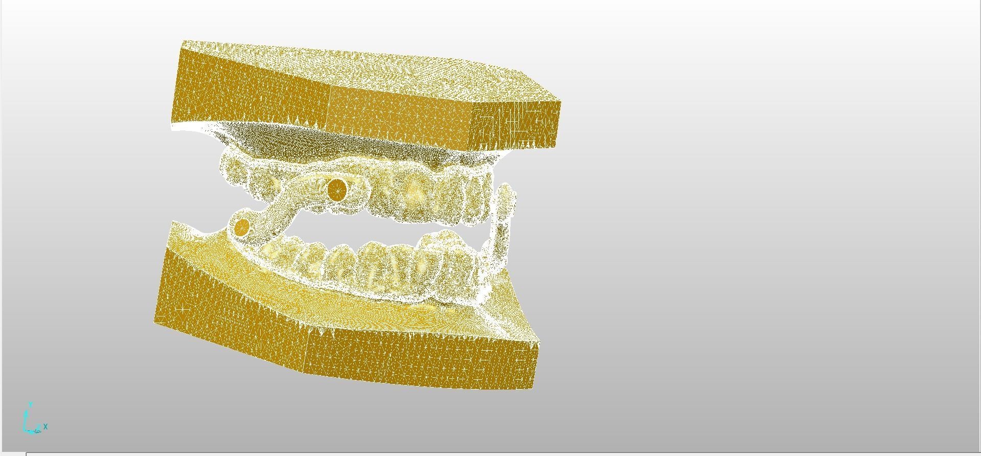 Digital Sleep Apnea Mouthguard 3D print model_6