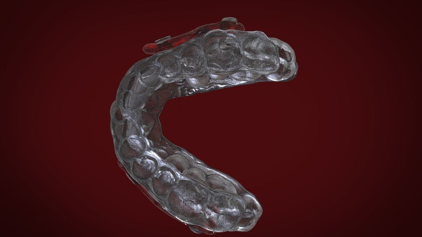 Digital Sleep Apnea Mouthguard 3D print model_8