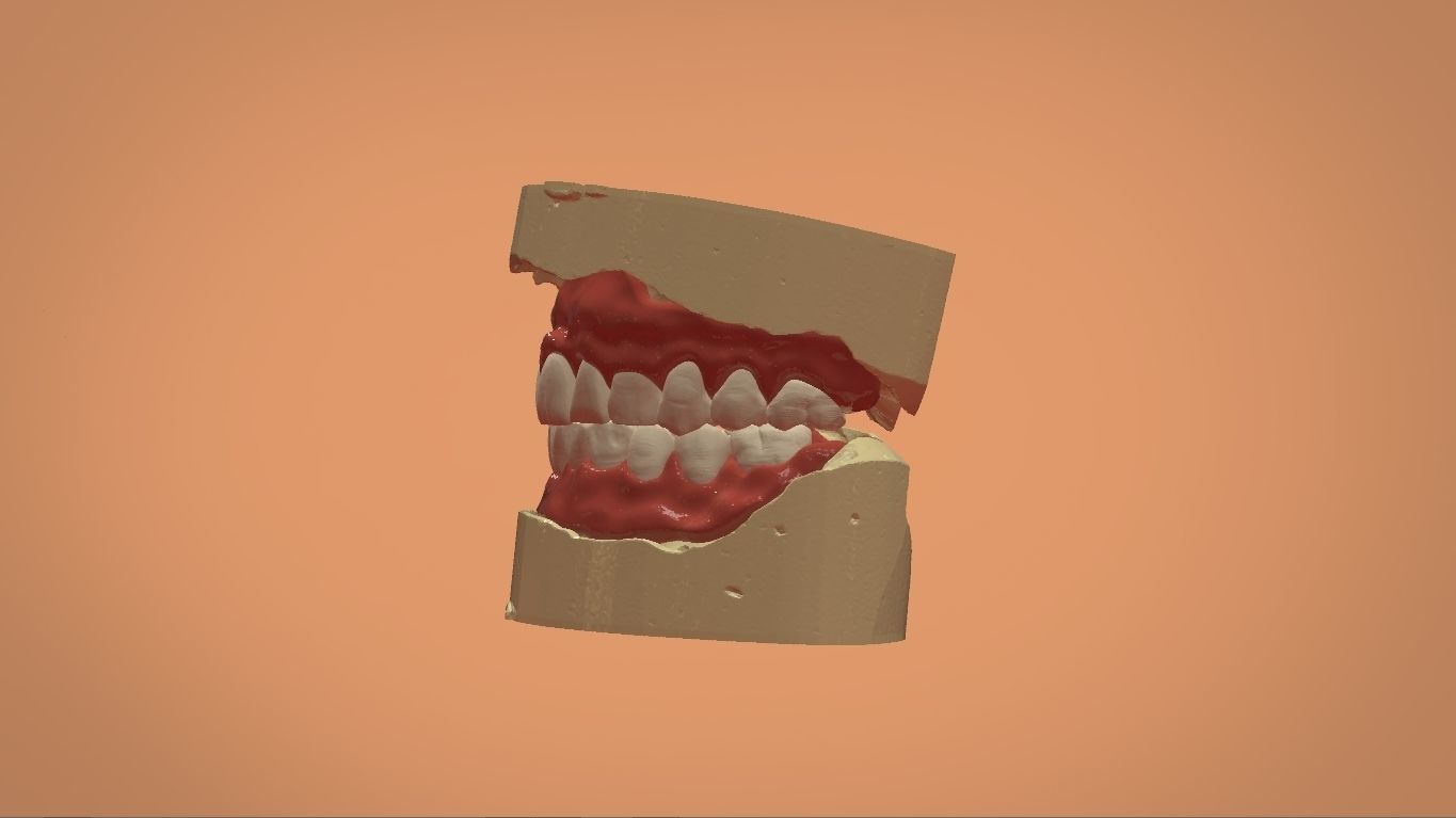 Digital Full Dentures for 3D Printing and Milling 3D print model_5